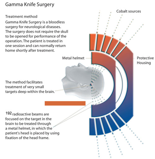 gamma-knife-diagram
