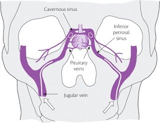 IPSS drawing